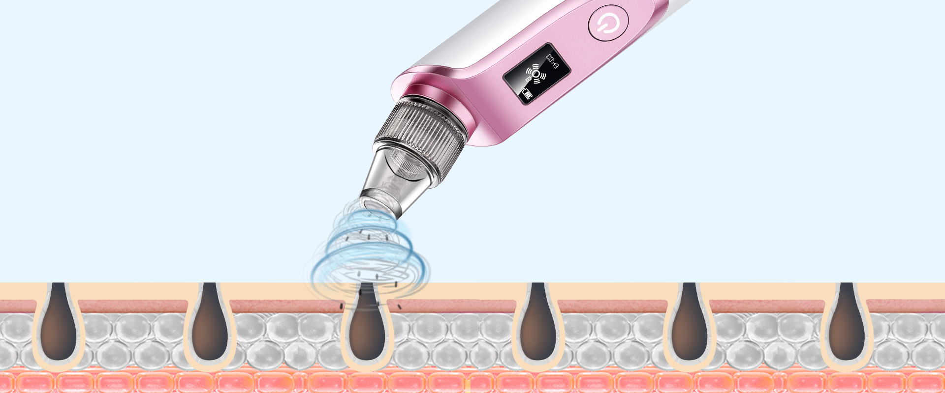 AEVO Blackhead Remover 2 2 AEVO Blackhead Remover 2 2